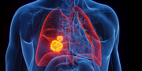 폐알레르기연구소 관련 사진